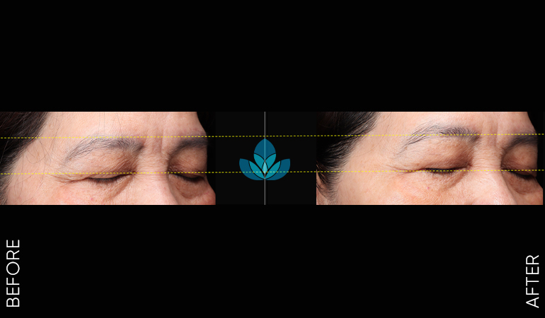 Trẻ hóa công nghệ cao